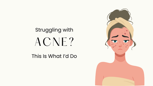 Struggling with Acne? This Is What I’d Do